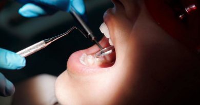 Odontología biológica vs. odontología convencional: Una comparación profunda